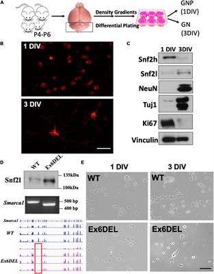 Impaired SNF2L Chromatin Remodeling Prolongs Accessibility at Promoters Enriched for Fos/Jun Binding Sites and Delays Granule Neuron Differentiation